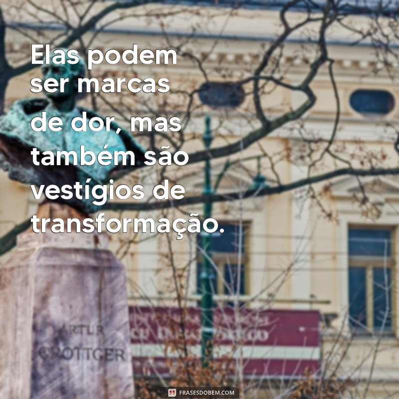 Frases Inspiradoras sobre Cicatrizes: Celebrando a Beleza das Marcas da Vida 