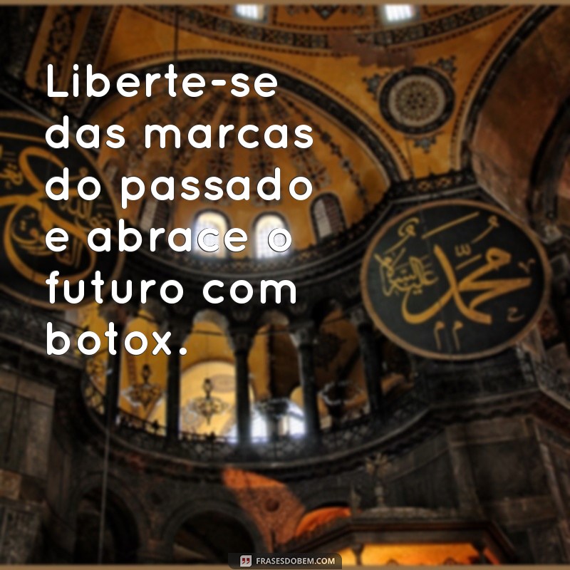 Frases Inspiradoras sobre Botox: Beleza, Confiança e Autoestima 