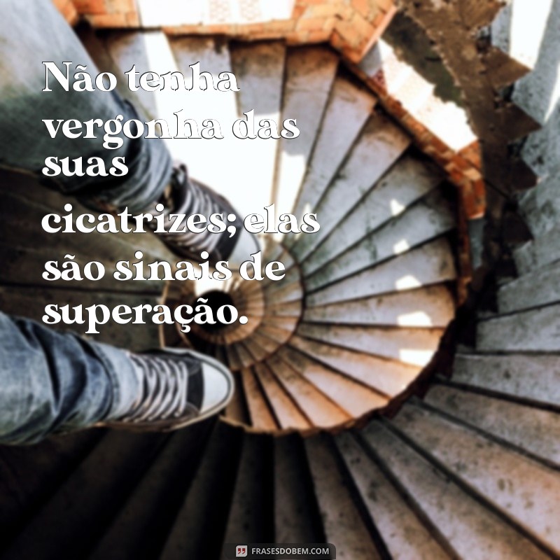 Frases Inspiradoras sobre Cicatrizes: Superando Desafios e Encontrando Força 