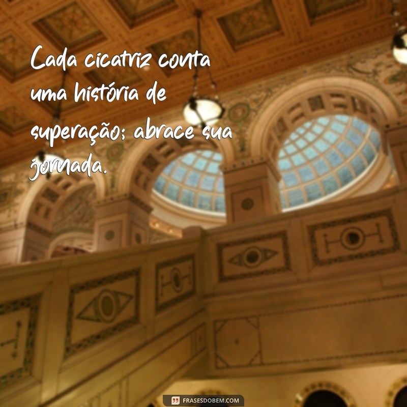 Frases Motivacionais para Superar o Bullying e Inspirar a Resiliência 